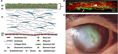 The IGF/Insulin-IGFBP Axis in Corneal Development, Wound Healing, and Disease